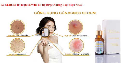 Serum trị mụn Shewhite có thể trị được hầu hết các loại mụn